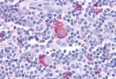 Immunohistochemistry-Paraffin: FPRL1/FPR2 Antibody [NBP3-14323]