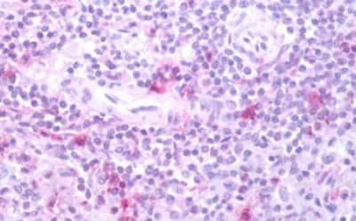 Immunohistochemistry-Paraffin: FPRL1/FPR2 Antibody [NBP3-14323]