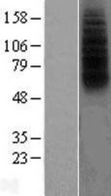 Western Blot: FPRL1/FPR2 Overexpression Lysate [NBP2-10977]