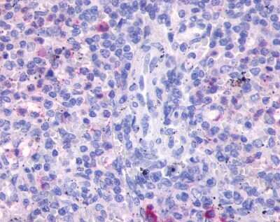 Immunohistochemistry-Paraffin: FPRL2/FPR3 Antibody - BSA Free [NLS3733]