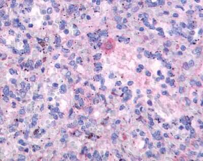 Immunohistochemistry-Paraffin: FPRL2/FPR3 Antibody - BSA Free [NLS3735]