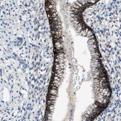 Immunohistochemistry-Paraffin: FPRP/PTGFRN Antibody [NBP1-85762]