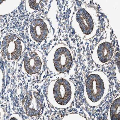 Immunohistochemistry-Paraffin: FPRP/PTGFRN Antibody [NBP1-85762]