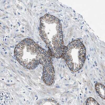 Immunohistochemistry-Paraffin: FPRP/PTGFRN Antibody [NBP1-85762]