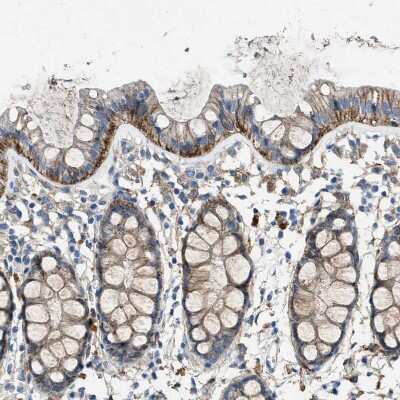 Immunohistochemistry-Paraffin: FPRP/PTGFRN Antibody [NBP1-85762]