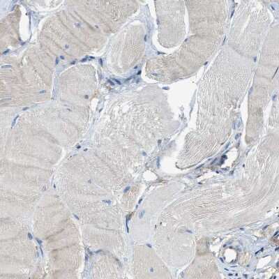 Immunohistochemistry-Paraffin: FPRP/PTGFRN Antibody [NBP1-85762]