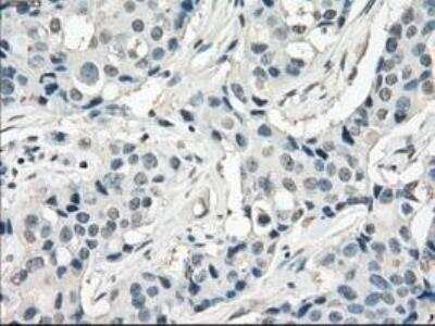 Immunohistochemistry-Paraffin: FRA-1/FOSL1 Antibody (OTI12F9) [NBP1-47757]