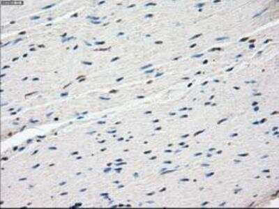 Immunohistochemistry-Paraffin: FRA-1/FOSL1 Antibody (OTI12F9) [NBP1-47757]