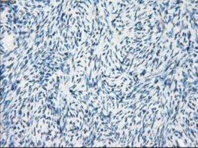 Immunohistochemistry-Paraffin: FRA-1/FOSL1 Antibody (OTI12F9) [NBP1-47757]