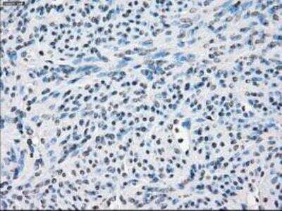 Immunohistochemistry-Paraffin: FRA-1/FOSL1 Antibody (OTI12F9) [NBP1-47757]