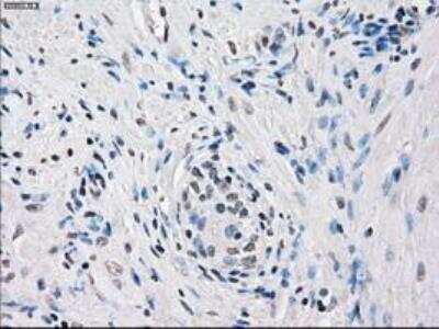 Immunohistochemistry-Paraffin: FRA-1/FOSL1 Antibody (OTI12F9) [NBP1-47757]