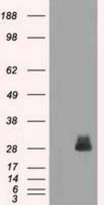 Western Blot: FRA-1/FOSL1 Antibody (OTI12F9) [NBP1-47757]