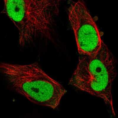 Immunocytochemistry/ Immunofluorescence: FRA-1/FOSL1 Antibody [NBP2-57326]