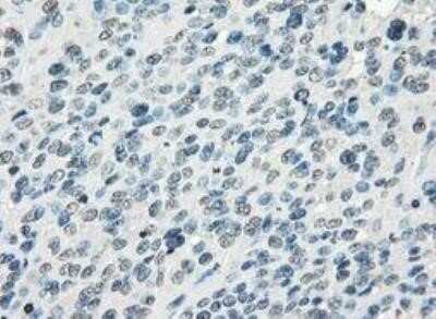 Immunohistochemistry: FRA-1/FOSL1 Antibody (OTI12F9) - Azide and BSA Free [NBP2-71351]