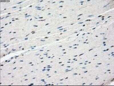 Immunohistochemistry: FRA-1/FOSL1 Antibody (OTI12F9) - Azide and BSA Free [NBP2-71351]