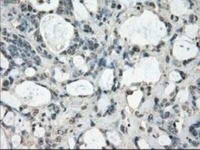 Immunohistochemistry: FRA-1/FOSL1 Antibody (OTI12F9) - Azide and BSA Free [NBP2-71351]