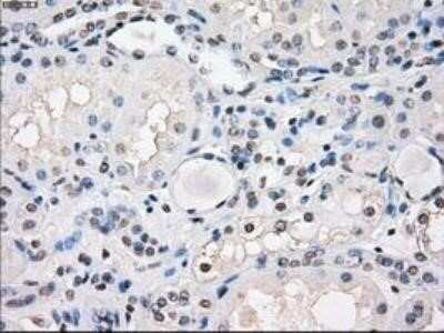 Immunohistochemistry: FRA-1/FOSL1 Antibody (OTI12F9) - Azide and BSA Free [NBP2-71351]