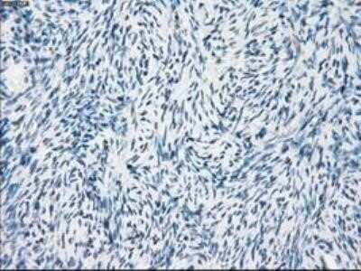 Immunohistochemistry: FRA-1/FOSL1 Antibody (OTI12F9) - Azide and BSA Free [NBP2-71351]