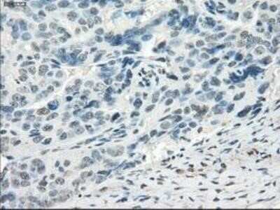 Immunohistochemistry: FRA-1/FOSL1 Antibody (OTI12F9) - Azide and BSA Free [NBP2-71351]