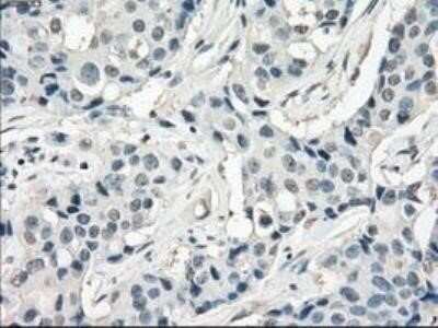 Immunohistochemistry: FRA-1/FOSL1 Antibody (OTI12F9) - Azide and BSA Free [NBP2-71351]