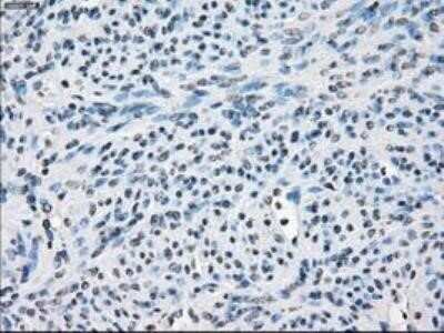 Immunohistochemistry: FRA-1/FOSL1 Antibody (OTI12F9) - Azide and BSA Free [NBP2-71351]