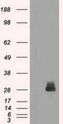 Western Blot: FRA-1/FOSL1 Antibody (OTI12F9)Azide and BSA Free [NBP2-71351]