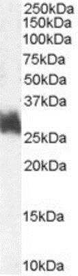 Western Blot: FRA-1/FOSL1 Antibody [NB100-40803]