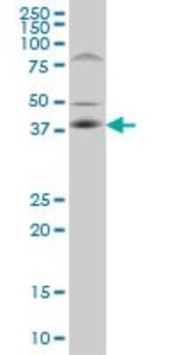 Western Blot: FRA10AC1 Antibody (2C4) [H00118924-M02]