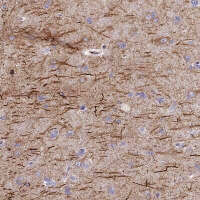 Immunohistochemistry-Paraffin: FRA10AC1 Antibody [NBP1-88533]