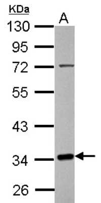 Western Blot: FRA10AC1 Antibody [NBP2-16528]