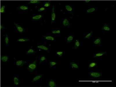 Immunocytochemistry/ Immunofluorescence: FRA2 Antibody (2B2) [H00002355-M03]