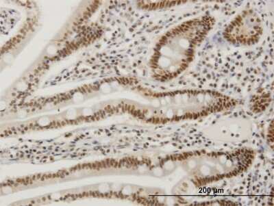 Immunohistochemistry-Paraffin: FRA2 Antibody (2B2) [H00002355-M03]