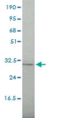 Western Blot: FRA2 Antibody (2B4-1C2) [H00002355-M01]