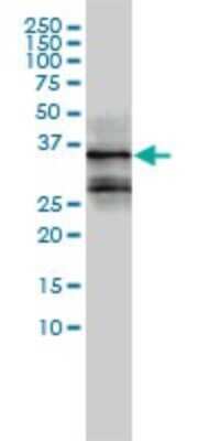 Western Blot: FRA2 Antibody (2B4-1C2) [H00002355-M01]