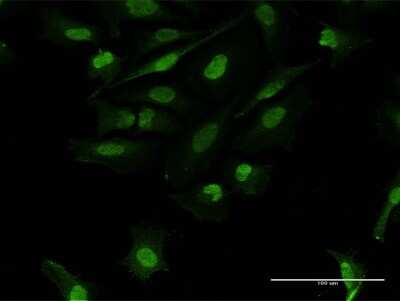 Immunocytochemistry/ Immunofluorescence: FRA2 Antibody [H00002355-B01P]