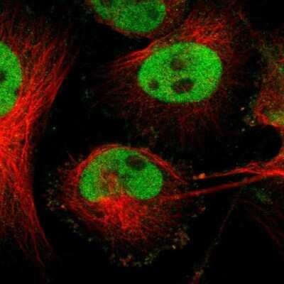 Immunocytochemistry/ Immunofluorescence: FRA2 Antibody [NBP1-89842]