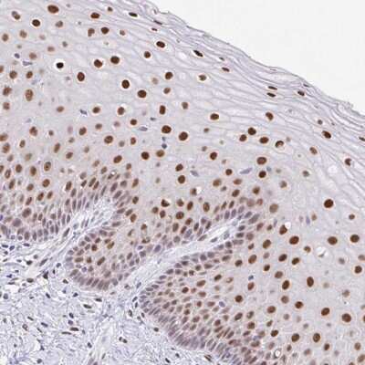 Immunohistochemistry-Paraffin: FRA2 Antibody [NBP2-38919]