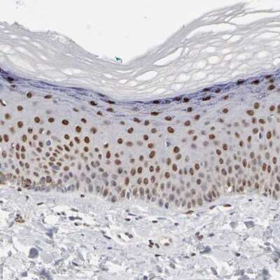 Immunohistochemistry-Paraffin: FRA2 Antibody [NBP1-89842]