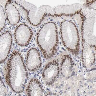 Immunohistochemistry-Paraffin: FRA2 Antibody [NBP1-89842]