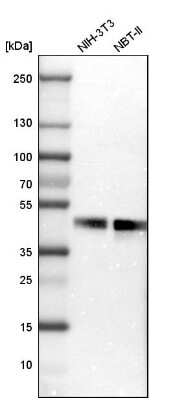 Western Blot: FRA2 Antibody [NBP1-89842]
