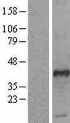 Western Blot: FRA2 Overexpression Lysate [NBL1-10797]