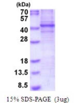 SDS-PAGE: Recombinant Human FRA2 His Protein [NBP2-51975]