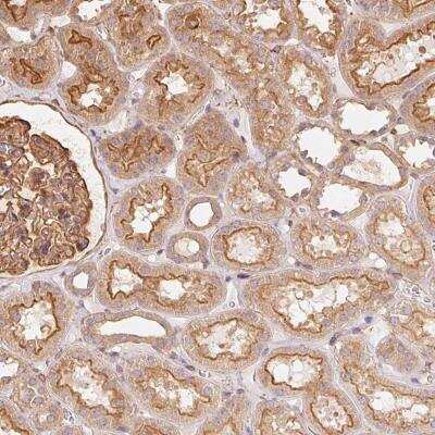 Immunohistochemistry-Paraffin: FRAS1 (Fraser syndrome 1) Antibody [NBP2-38656]