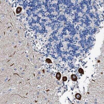 Immunohistochemistry: FRAS1 Related Extracellular Matrix 3 Antibody [NBP2-30847]