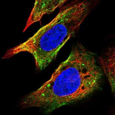 Immunocytochemistry/ Immunofluorescence: FRAT1 Antibody [NBP2-58219]