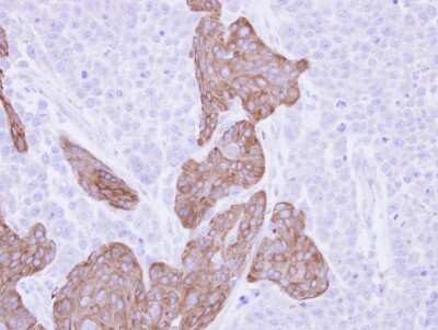 Immunohistochemistry-Paraffin: FRAT1 Antibody [NBP1-31213]