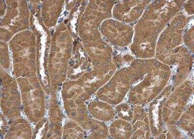 Immunohistochemistry-Paraffin: FRAT1 Antibody [NBP1-31213]