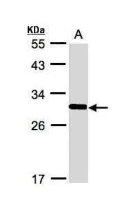 Western Blot: FRAT1 Antibody [NBP1-31213]