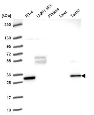 Western Blot: FRAT1 Antibody [NBP2-58219]