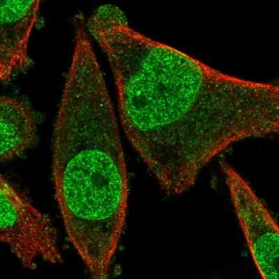 Immunocytochemistry/ Immunofluorescence: FRAT2 Antibody [NBP2-14026]